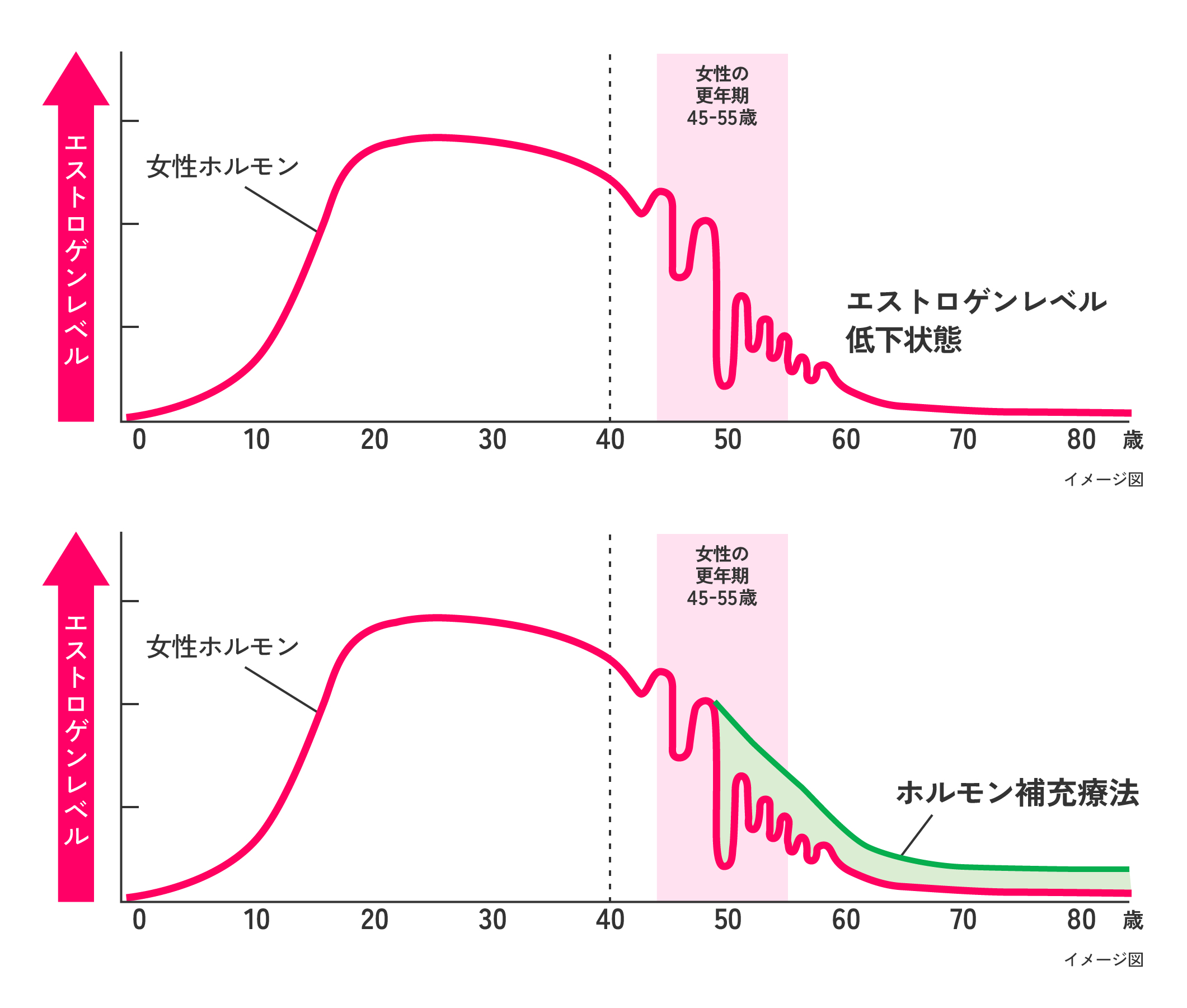 血中エストロゲン,欠乏状態,HRT