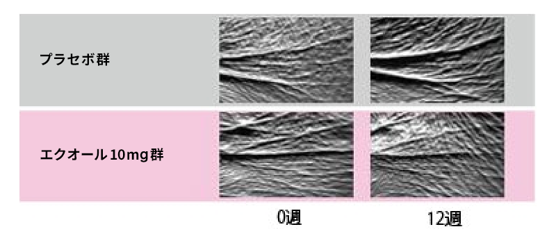 女性ホルモンの減少が目尻のシワを招く!?健やかな肌を保つ方法