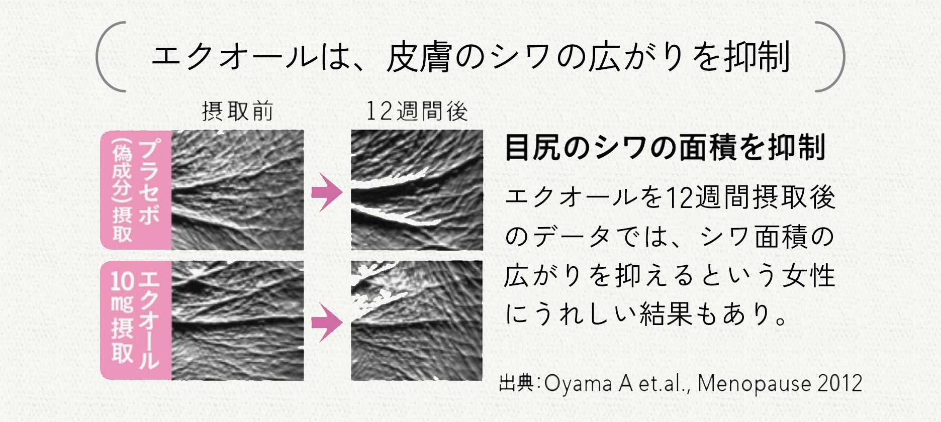 エクオール豆知識 エクオールは皮膚のシワを抑制