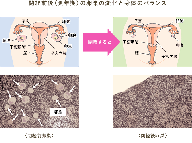 閉経前後（更年期）の卵巣の変化と身体のバランス｜麻生武志・寺内公一・宮原富士子：『インフォームドコンセントのための図説シリーズ ホルモン補充療法 改訂版』 p.18-19， 2012