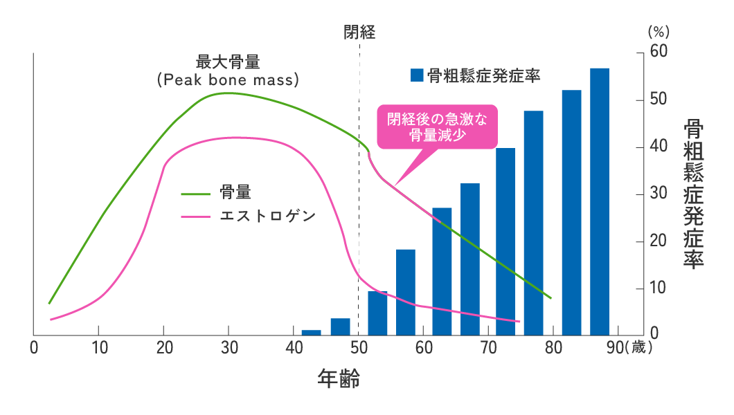骨粗鬆症発症率と年齢|(藤田拓男:臨床婦人科産科 43:677-680, 1989より作成)(山本逸雄:Osteoporosis Japan 7:10-11, 1999より作成)